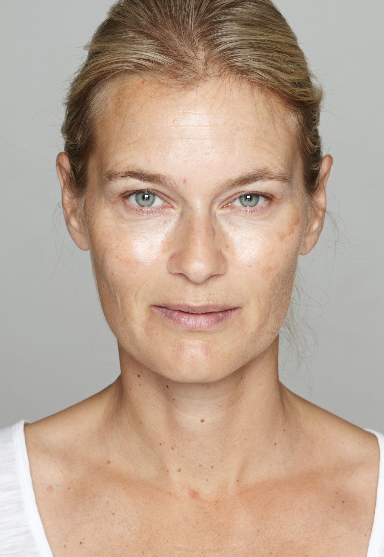 Hautverjüngung Gesicht