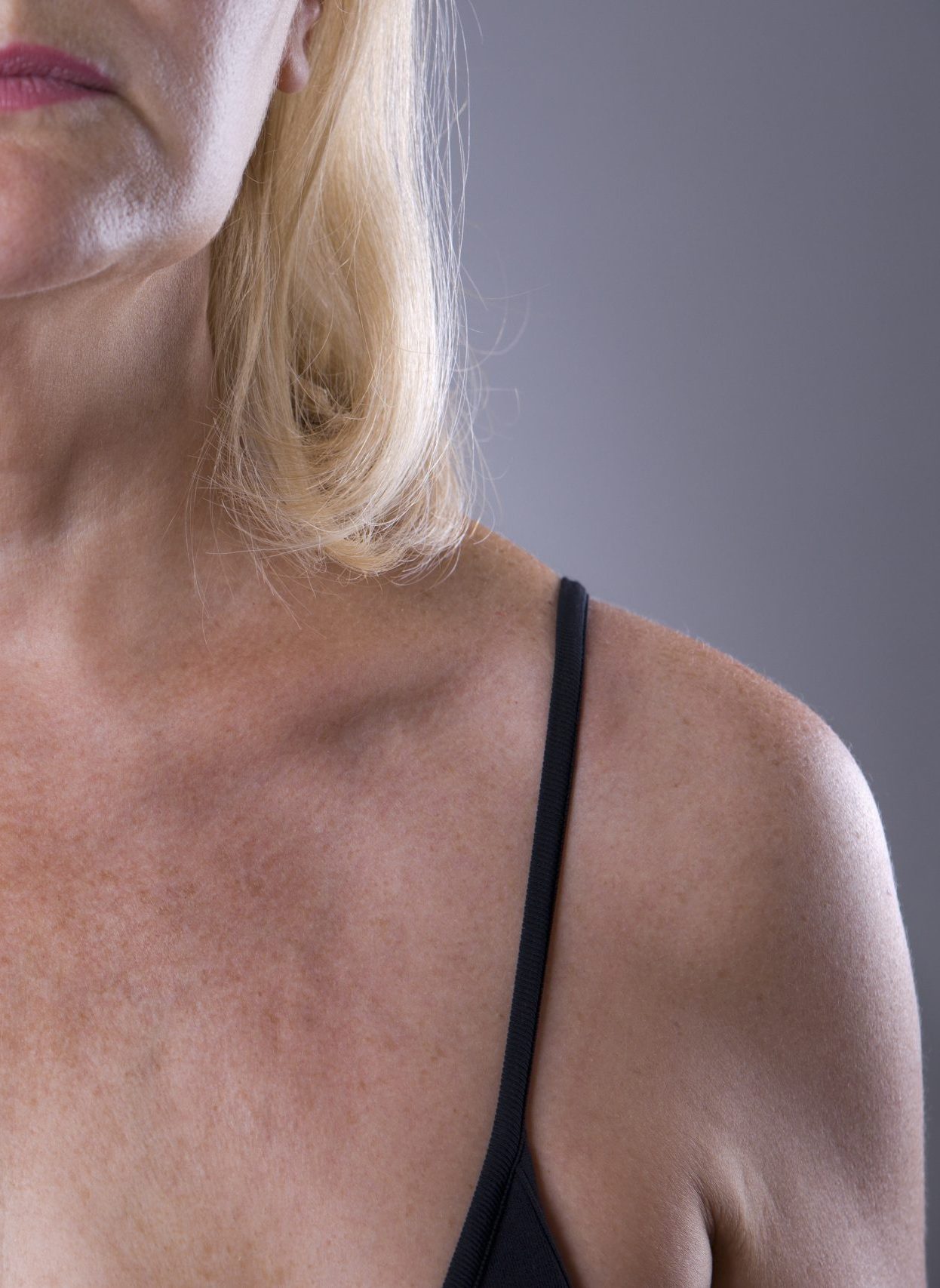 Hautverjüngung Dekolleté