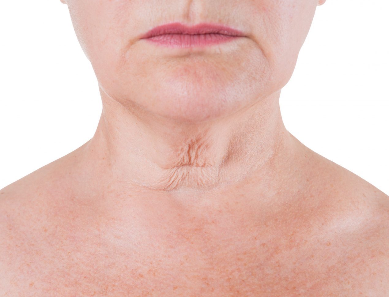 Hautverjüngung Hals